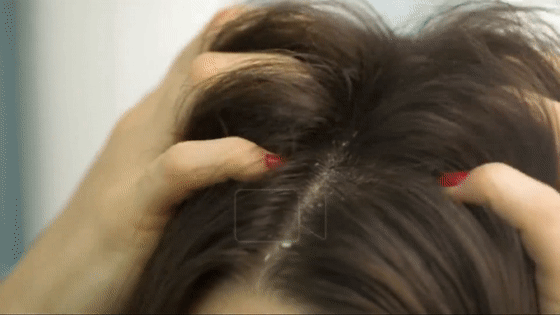 生姜洗头有多好？用了才知道，防脱还控油！99%的人竟然不知道