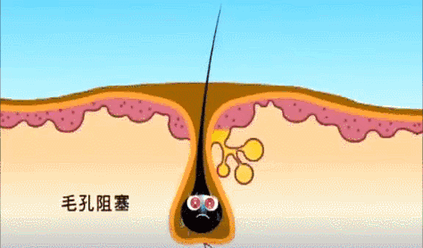 生姜洗头有多好？用了才知道，防脱还控油！99%的人竟然不知道