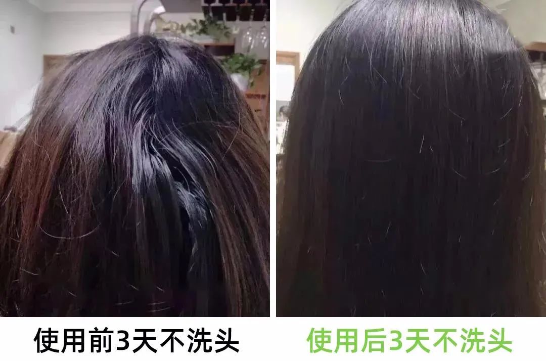 生姜洗头有多好？用了才知道，防脱还控油！99%的人竟然不知道