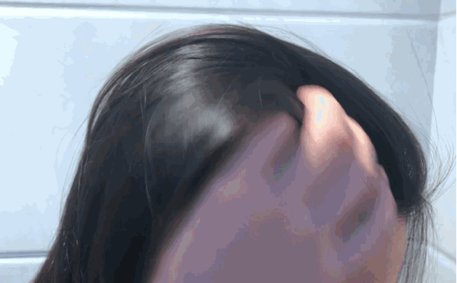 生姜洗头有多好？用了才知道，防脱还控油！99%的人竟然不知道
