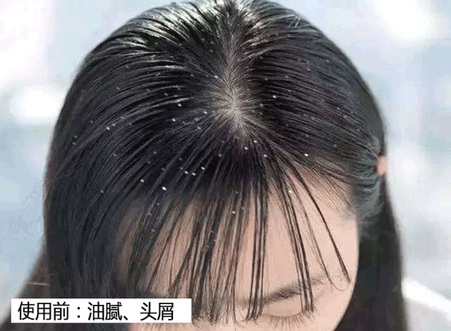 生姜洗头有多好？用了才知道，防脱还控油！99%的人竟然不知道